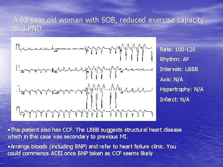 A 63 year old woman with SOB, reduced exercise capacity and PND Rate: 100