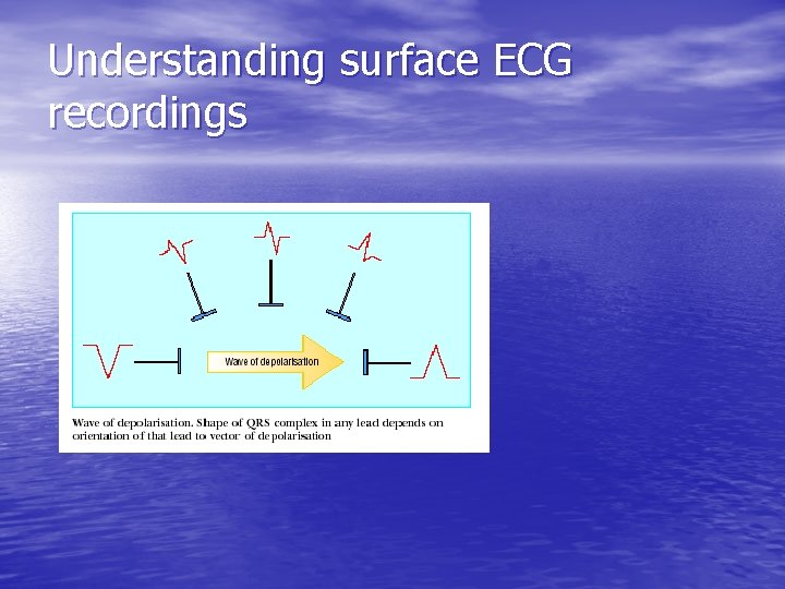 Understanding surface ECG recordings 