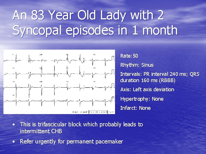 An 83 Year Old Lady with 2 Syncopal episodes in 1 month Rate: 50