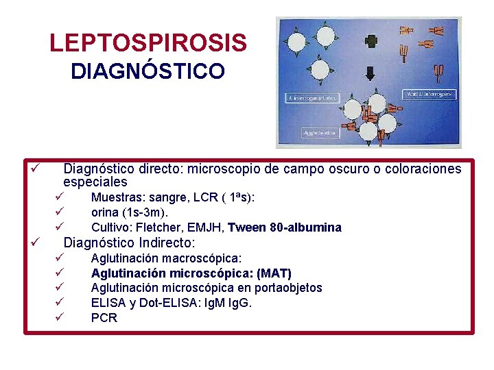 LEPTOSPIROSIS DIAGNÓSTICO ü Diagnóstico directo: microscopio de campo oscuro o coloraciones especiales ü ü