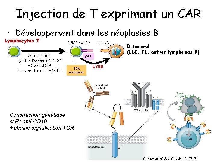 Injection de T exprimant un CAR • Développement dans les néoplasies B Lymphocytes T