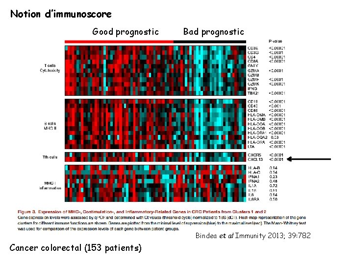 Notion d’immunoscore Good prognostic Bad prognostic Bindea et al Immunity 2013; 39: 782 Cancer