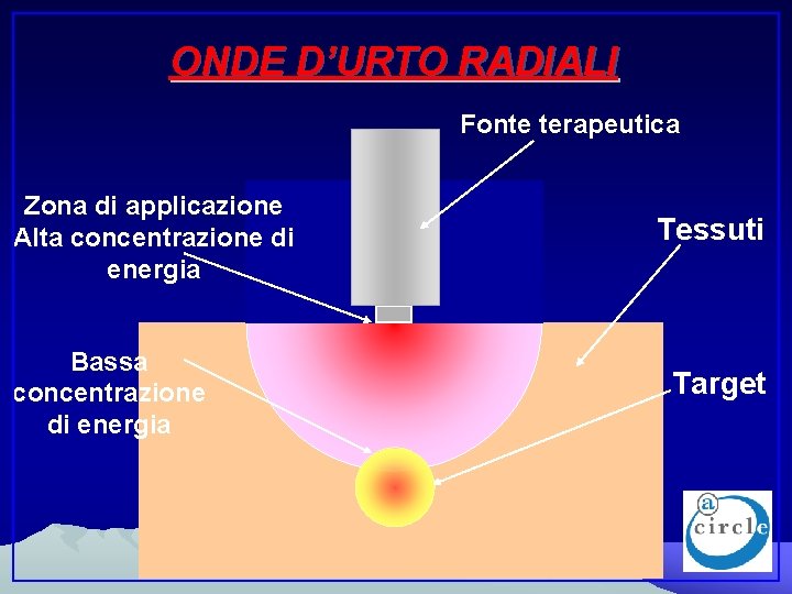 ONDE D’URTO RADIALI Fonte terapeutica Zona di applicazione Alta concentrazione di energia Bassa concentrazione
