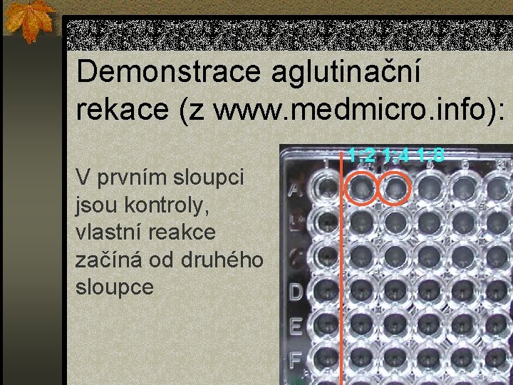 Demonstrace aglutinační rekace (z www. medmicro. info): V prvním sloupci jsou kontroly, vlastní reakce