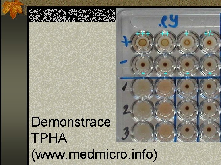 +++ ++ + +/- - - Demonstrace TPHA (www. medmicro. info) 