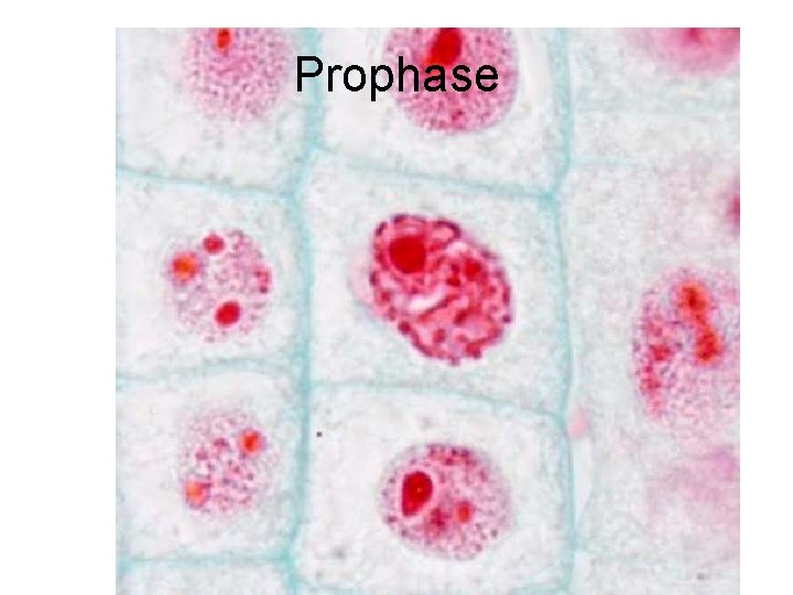 Prophase 