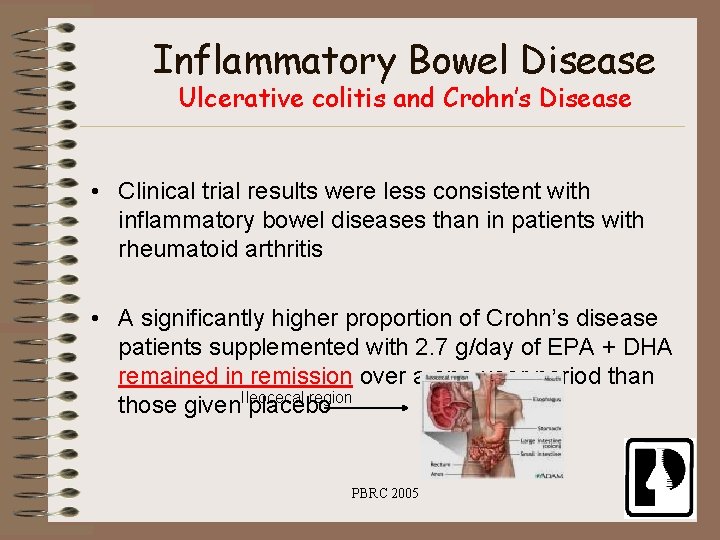 Inflammatory Bowel Disease Ulcerative colitis and Crohn’s Disease • Clinical trial results were less