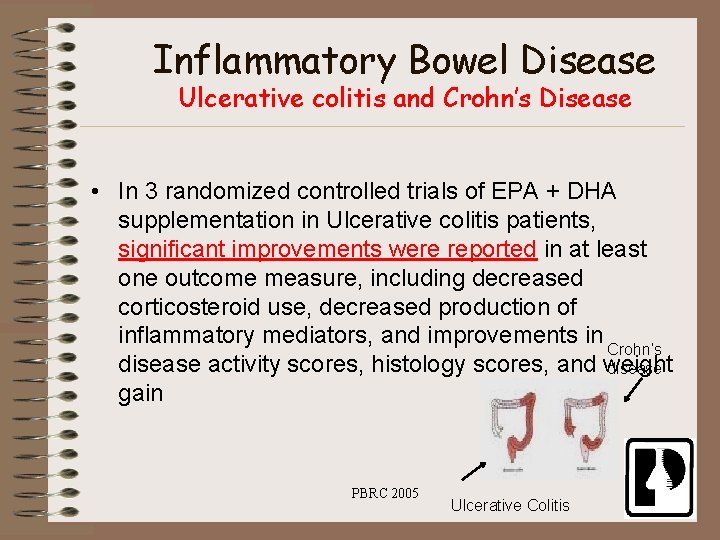 Inflammatory Bowel Disease Ulcerative colitis and Crohn’s Disease • In 3 randomized controlled trials