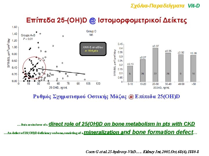 Σχόλια-Παραδείγματα Vit-D Επίπεδα 25 -(OH)D @ Ιστομορφομετρικοί Δείκτες ΧΝΝ-5 σταδίου n: 104 pts Ρυθμός