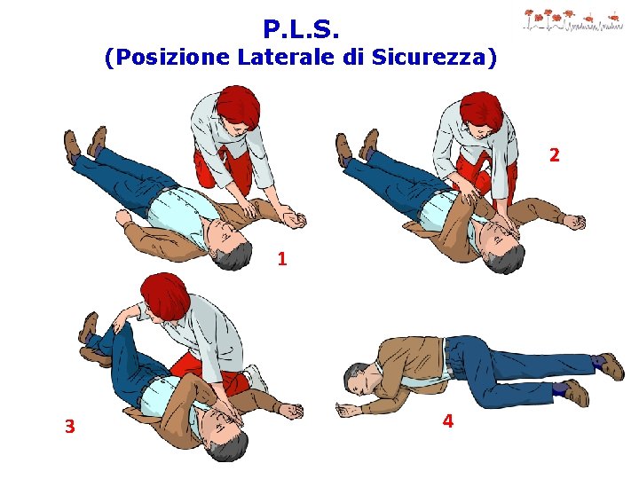 P. L. S. (Posizione Laterale di Sicurezza) 2 1 3 4 