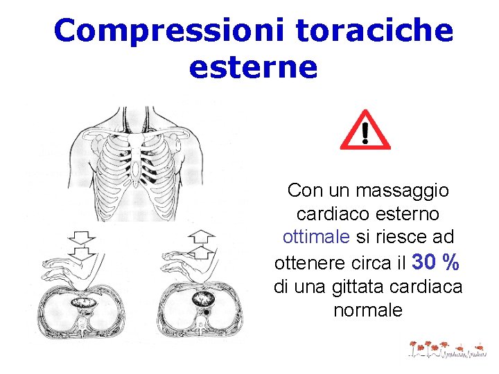 Compressioni toraciche esterne Con un massaggio cardiaco esterno ottimale si riesce ad ottenere circa