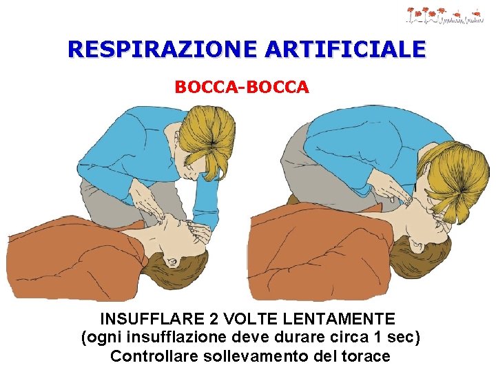 RESPIRAZIONE ARTIFICIALE BOCCA-BOCCA INSUFFLARE 2 VOLTE LENTAMENTE (ogni insufflazione deve durare circa 1 sec)