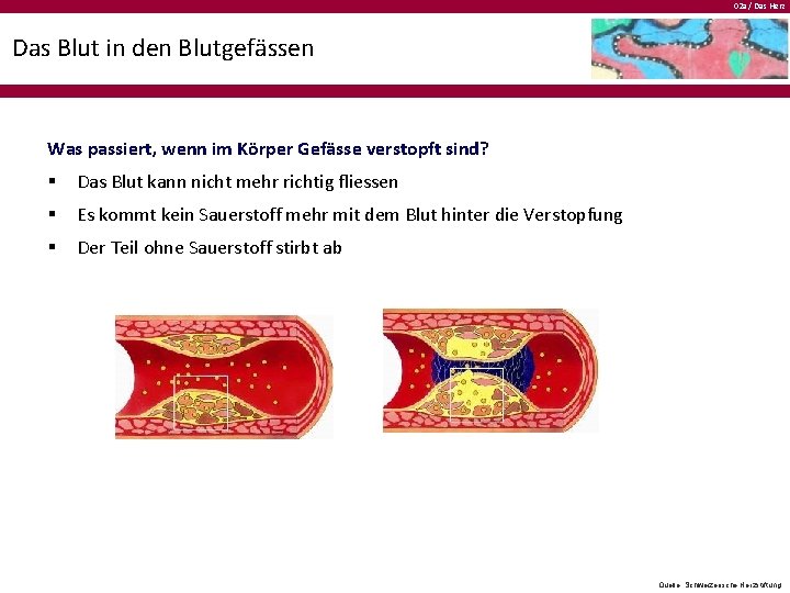 02 a / Das Herz Das Blut in den Blutgefässen Was passiert, wenn im