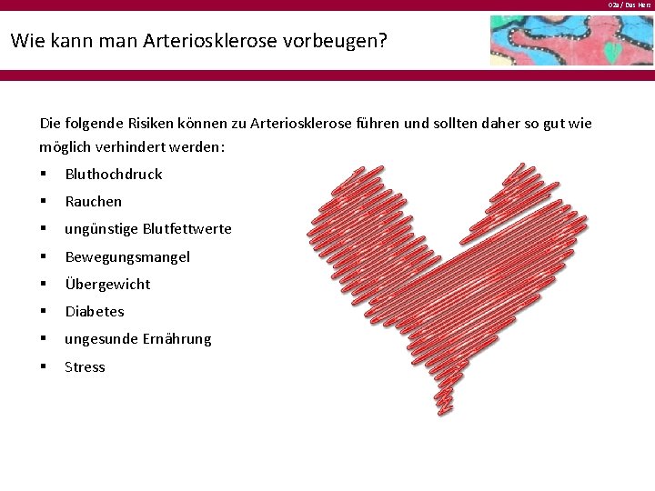 02 a / Das Herz Wie kann man Arteriosklerose vorbeugen? Die folgende Risiken können