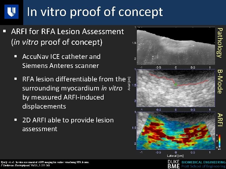 Distorted Rfa Scan Ut CLINICAL EVALUATION OF AN ULTRASOUND BASED IMAGING SYSTEM