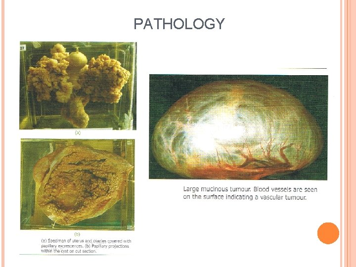 PATHOLOGY 