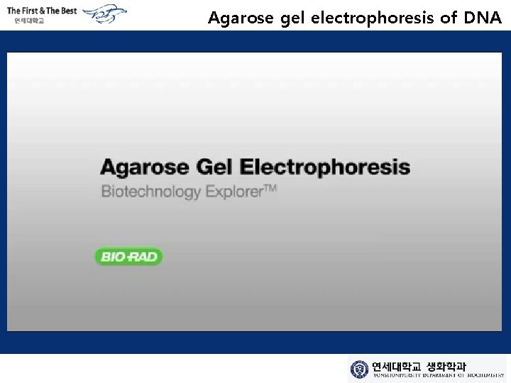 Agarose gel electrophoresis of DNA 