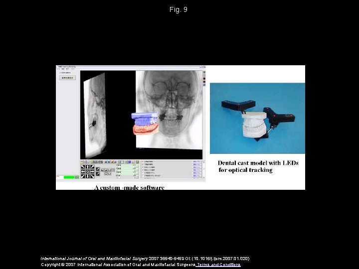 Fig. 9 International Journal of Oral and Maxillofacial Surgery 2007 36640 -645 DOI: (10.