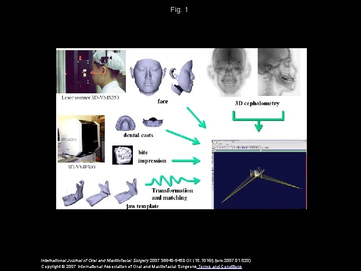 Fig. 1 International Journal of Oral and Maxillofacial Surgery 2007 36640 -645 DOI: (10.