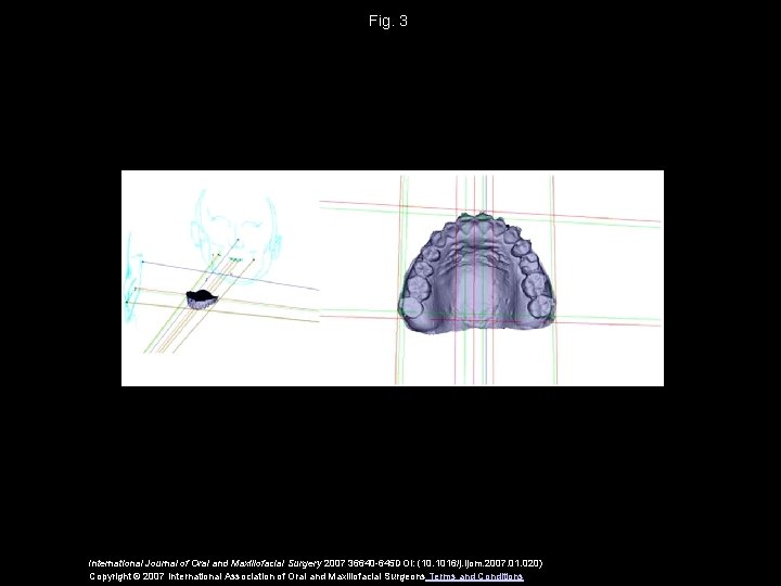 Fig. 3 International Journal of Oral and Maxillofacial Surgery 2007 36640 -645 DOI: (10.