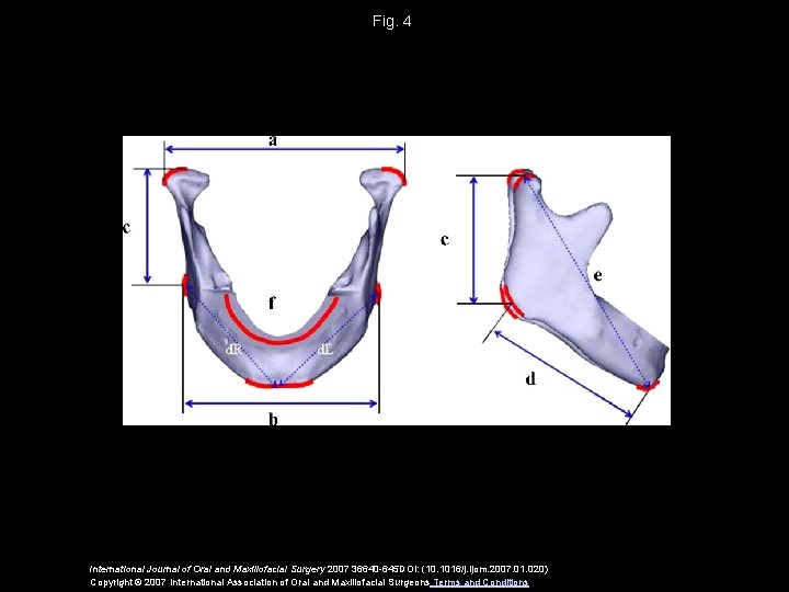 Fig. 4 International Journal of Oral and Maxillofacial Surgery 2007 36640 -645 DOI: (10.