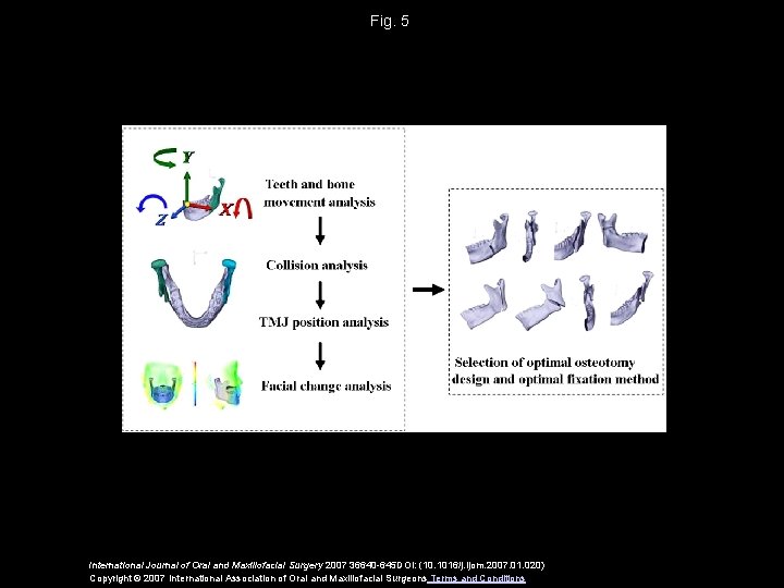 Fig. 5 International Journal of Oral and Maxillofacial Surgery 2007 36640 -645 DOI: (10.