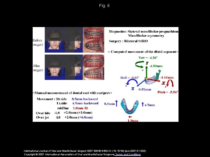 Fig. 6 International Journal of Oral and Maxillofacial Surgery 2007 36640 -645 DOI: (10.