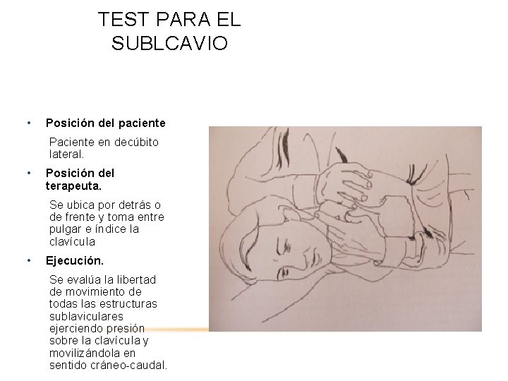 TEST PARA EL SUBLCAVIO • Posición del paciente Paciente en decúbito lateral. • Posición