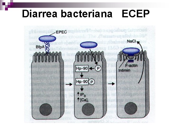 Diarrea bacteriana ECEP 