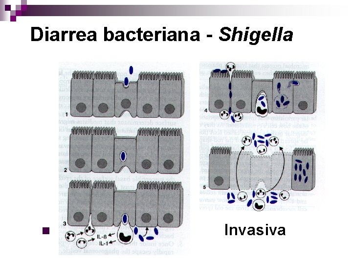 Diarrea bacteriana - Shigella n Invasiva 