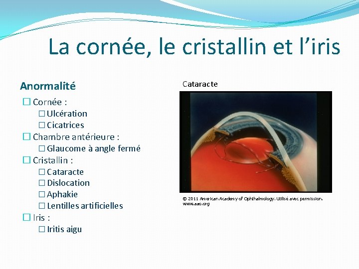La cornée, le cristallin et l’iris Anormalité � Cornée : � Ulcération � Cicatrices La cornée, le cristallin et l’iris Anormalité � Cornée : � Ulcération � Cicatrices