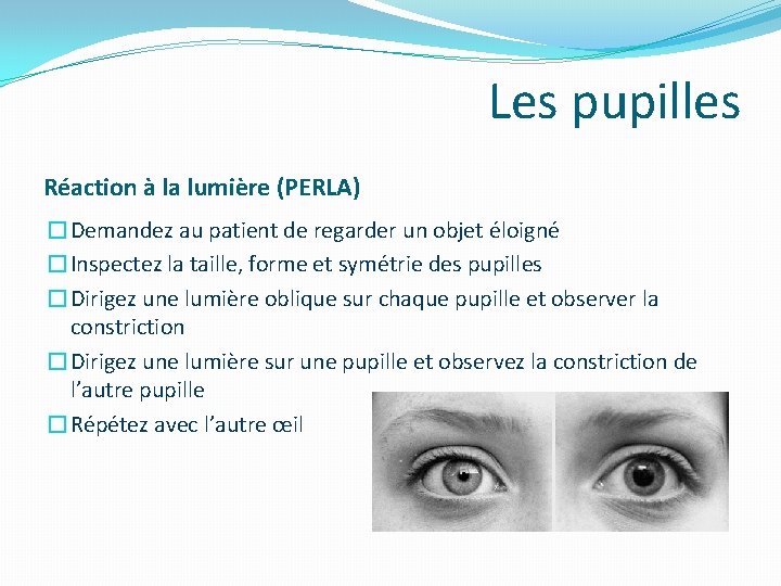 Les pupilles Réaction à la lumière (PERLA) �Demandez au patient de regarder un objet Les pupilles Réaction à la lumière (PERLA) �Demandez au patient de regarder un objet