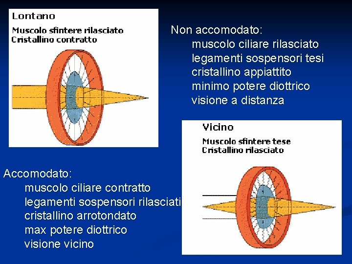 Non accomodato: muscolo ciliare rilasciato legamenti sospensori tesi cristallino appiattito minimo potere diottrico visione