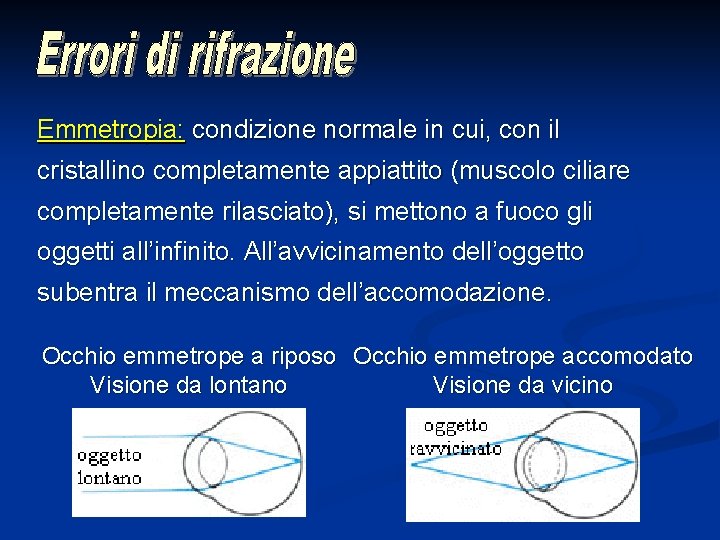 Emmetropia: condizione normale in cui, con il cristallino completamente appiattito (muscolo ciliare completamente rilasciato),