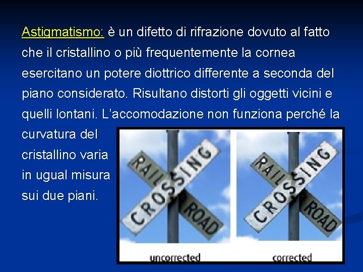 Astigmatismo: è un difetto di rifrazione dovuto al fatto che il cristallino o più