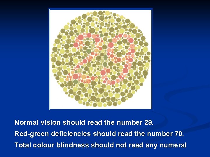 Normal vision should read the number 29. Red-green deficiencies should read the number 70.