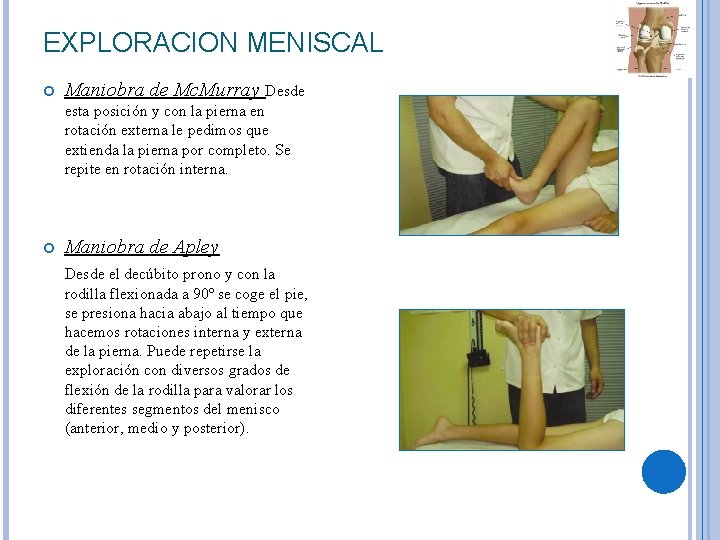 EXPLORACION MENISCAL Maniobra de Mc. Murray Desde esta posición y con la pierna en EXPLORACION MENISCAL Maniobra de Mc. Murray Desde esta posición y con la pierna en