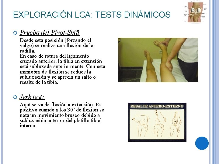 EXPLORACIÓN LCA: TESTS DINÁMICOS Prueba del Pivot-Shift Desde esta posición (forzando el valgo) se EXPLORACIÓN LCA: TESTS DINÁMICOS Prueba del Pivot-Shift Desde esta posición (forzando el valgo) se