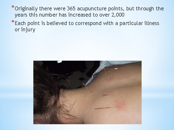 *Originally there were 365 acupuncture points, but through the years this number has increased
