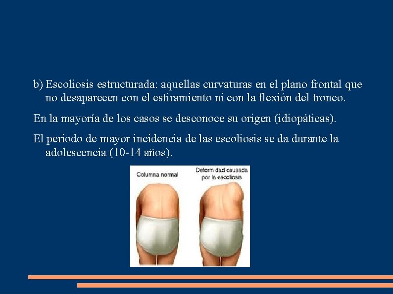 b) Escoliosis estructurada: aquellas curvaturas en el plano frontal que no desaparecen con el