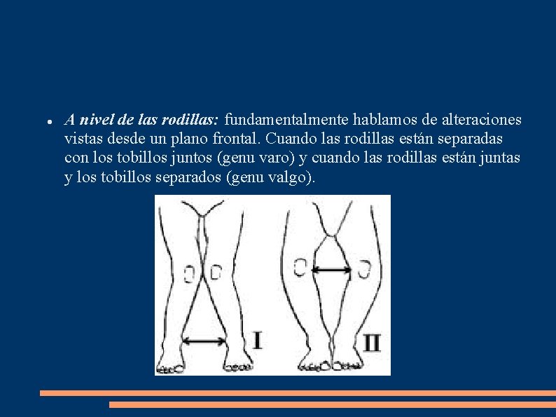  A nivel de las rodillas: fundamentalmente hablamos de alteraciones vistas desde un plano