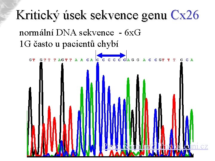 Kritický úsek sekvence genu Cx 26 normální DNA sekvence - 6 x. G 1