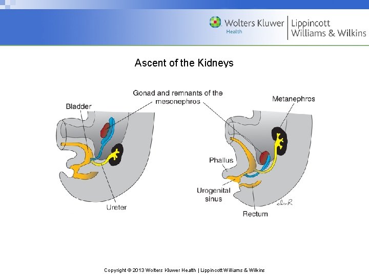 Ascent of the Kidneys Copyright © 2013 Wolters Kluwer Health | Lippincott Williams &