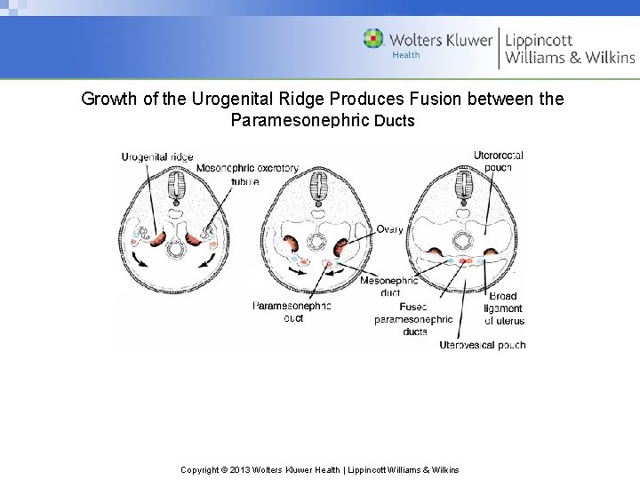 Growth of the Urogenital Ridge Produces Fusion between the Paramesonephric Ducts Copyright © 2013