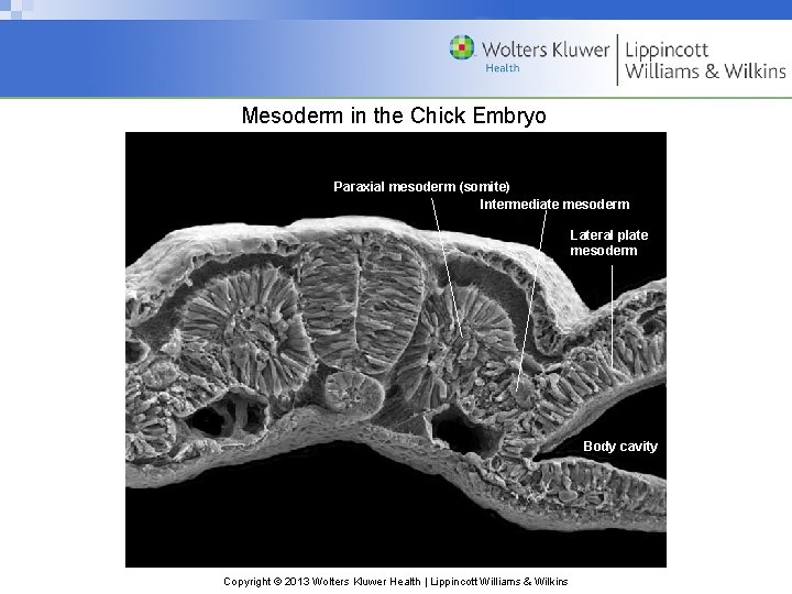 Mesoderm in the Chick Embryo Paraxial mesoderm (somite) Intermediate mesoderm Lateral plate mesoderm Body