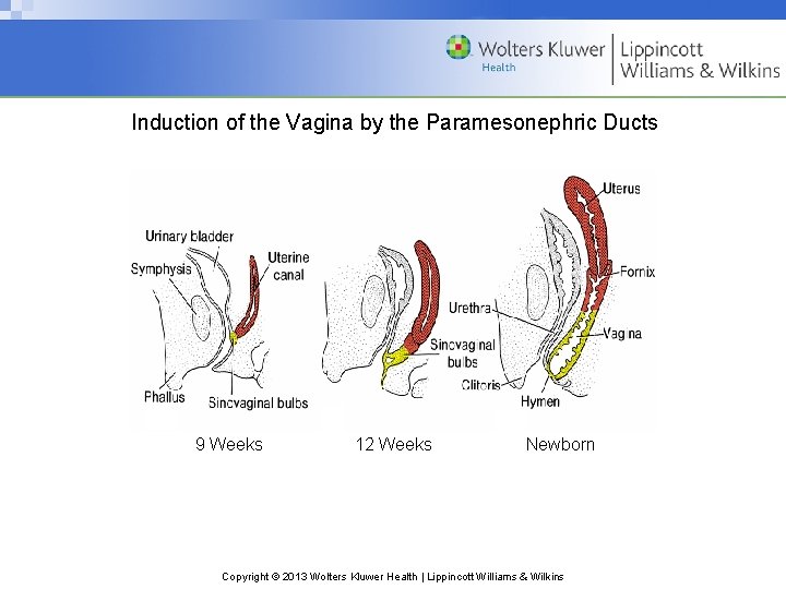 Induction of the Vagina by the Paramesonephric Ducts 9 Weeks 12 Weeks Newborn Copyright