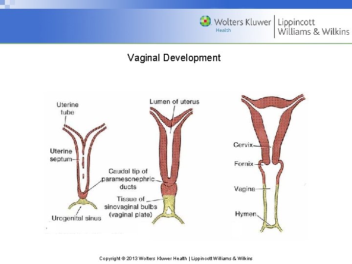 Vaginal Development Copyright © 2013 Wolters Kluwer Health | Lippincott Williams & Wilkins 