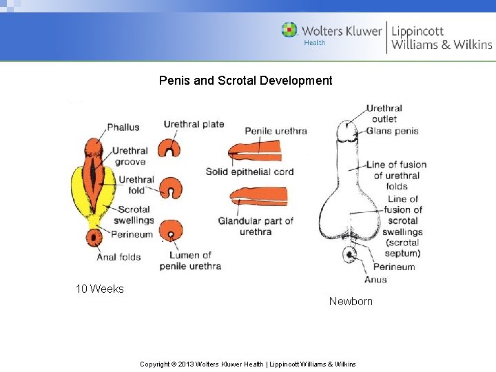 Penis and Scrotal Development 10 Weeks Newborn Copyright © 2013 Wolters Kluwer Health |