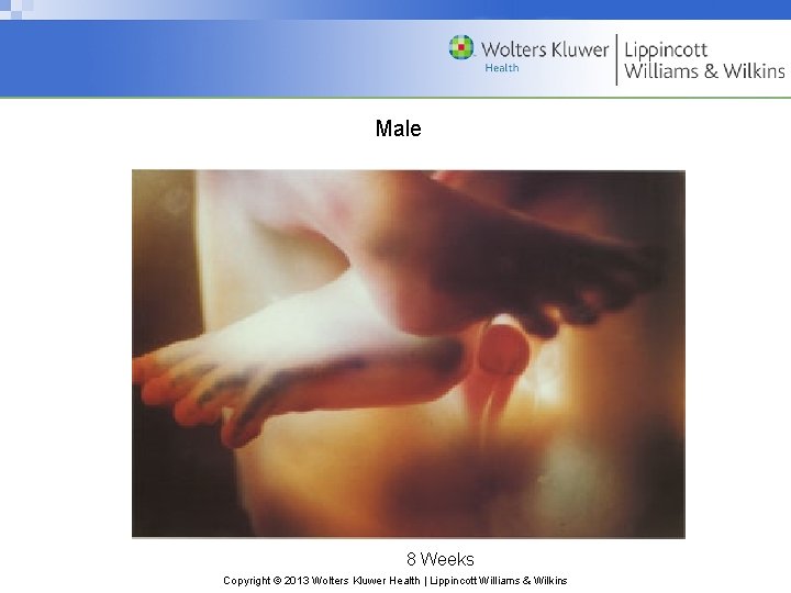 Male 8 Weeks Copyright © 2013 Wolters Kluwer Health | Lippincott Williams & Wilkins
