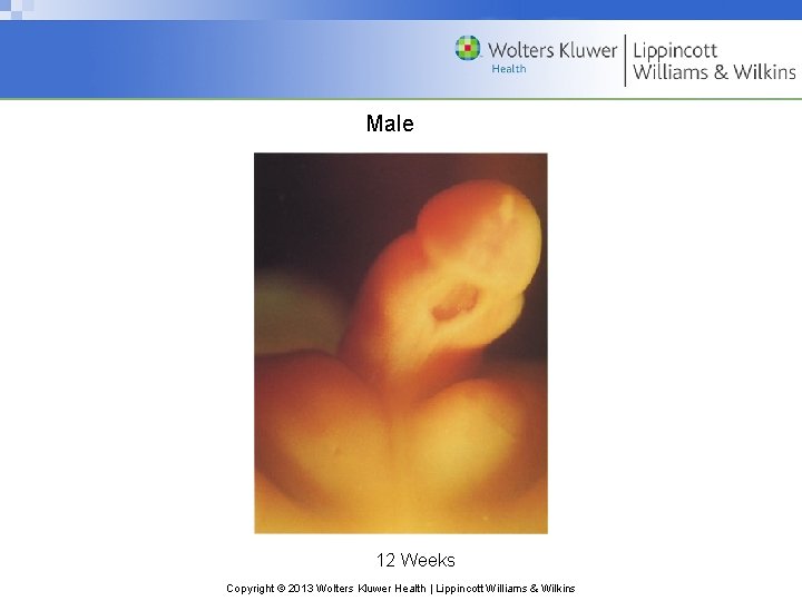 Male 12 Weeks Copyright © 2013 Wolters Kluwer Health | Lippincott Williams & Wilkins